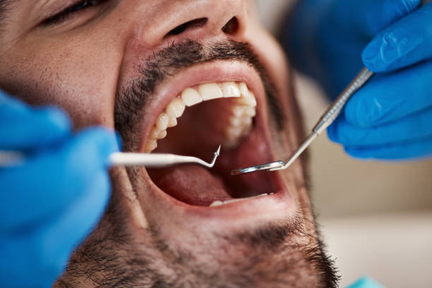 Emergency Dental Services in Beaumont, TX